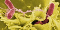image: Salmonella Strain Spreads Alongside HIV