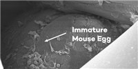 To Give Cancer Survivors a Chance to Conceive, Scientists are Designing Artificial Ovaries image: To Give Cancer Survivors a Chance to Conceive, Scientists are Designing Artificial Ovaries