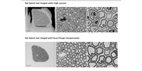 image: New Focal Charge Compensation mode for ZEISS field emission scanning electron microscopes improves image quality