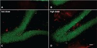 Experimental Drug Relieves Blast-Related PTSD in a Rat Model of Traumatic Brain Injury image: Experimental Drug Relieves Blast-Related PTSD in a Rat Model of Traumatic Brain Injury